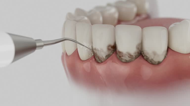 Trusted Dental Implants service in Ada, OK - Dentist Open Now